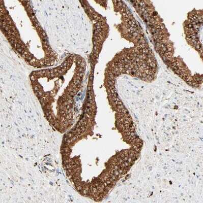 Immunohistochemistry-Paraffin: PSAP Antibody [NBP1-83363]