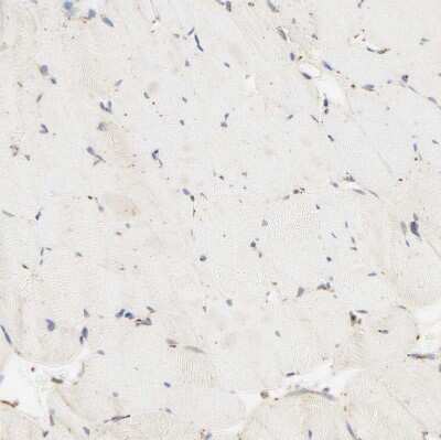 Immunohistochemistry-Paraffin: PSAP Antibody [NBP1-83363]