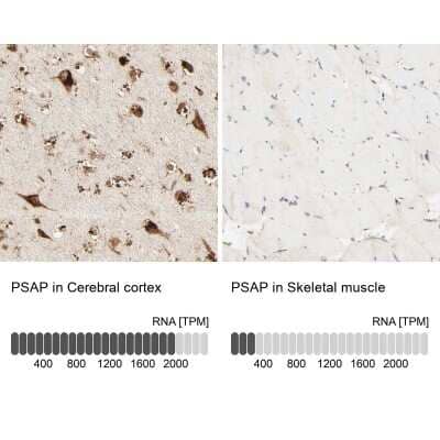 Immunohistochemistry-Paraffin: PSAP Antibody [NBP1-83363]