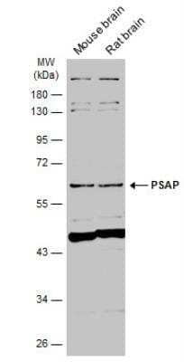 Western Blot: PSAP Antibody [NBP1-33459]