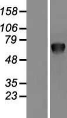 Western Blot: PSAP Overexpression Lysate [NBL1-14855]