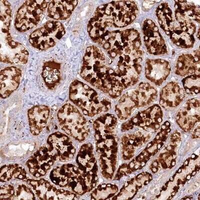 Immunohistochemistry-Paraffin: PSAPL1 Antibody [NBP1-90903]
