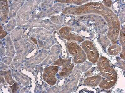 Immunohistochemistry-Paraffin: PSAT1 Antibody (GT2918) [NBP3-13545]