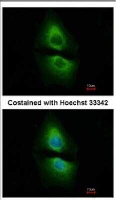 Immunocytochemistry/ Immunofluorescence: PSAT1 Antibody [NBP2-19973]