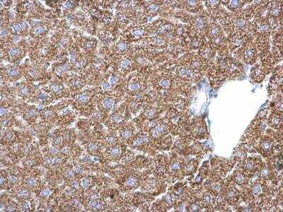 Immunohistochemistry-Paraffin: PSAT1 Antibody [NBP2-19973]