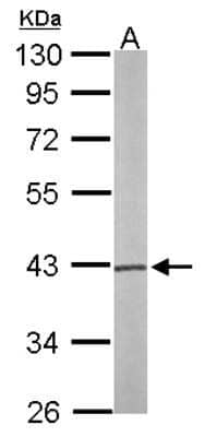 Western Blot: PSAT1 Antibody [NBP1-32920]
