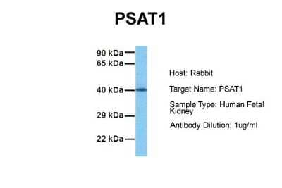 Western Blot: PSAT1 Antibody [NBP1-55368]