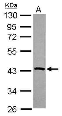 Western Blot: PSAT1 Antibody [NBP2-19973]