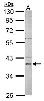 Western Blot: PSAT1 Antibody [NBP2-19973]