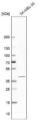 Western Blot: PSAT1 Antibody [NBP2-55269]