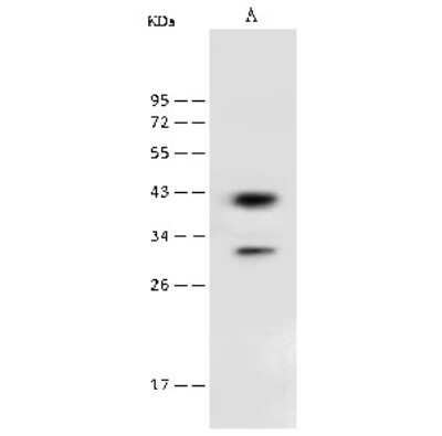 Western Blot: PSAT1 Antibody [NBP2-99608]