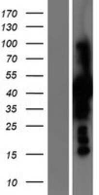 Western Blot: PSAT1 Overexpression Lysate [NBP2-05799]