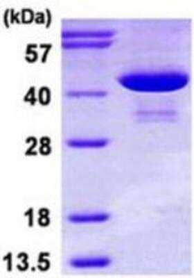 SDS-PAGE: Recombinant Human PSAT1 His Protein [NBP1-78827]