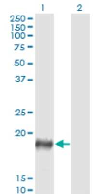 Western Blot: PSCA Antibody (5C2) [H00008000-M03]