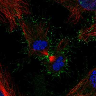 Immunocytochemistry/ Immunofluorescence: PSCA Antibody [NBP2-55295]