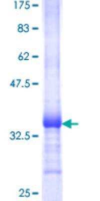 SDS-PAGE: Recombinant Human PSCA GST (N-Term) Protein [H00008000-Q01]