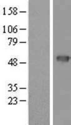 Western Blot: Cytohesin 4 Overexpression Lysate [NBL1-14858]