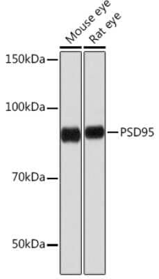 Western Blot: PSD-95 Antibody (0M7N4) [NBP3-15251]