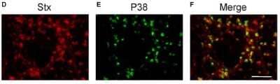 Immunohistochemistry-Paraffin: PSD-95 Antibody (6G6-1C9) - BSA Free [NB300-556]