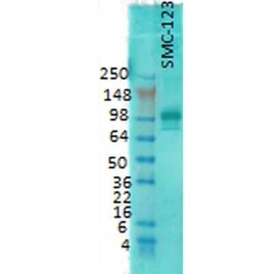 Western Blot: PSD-95 Antibody (7E3) [NBP2-12872]