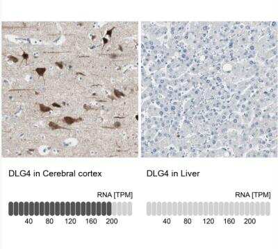 Immunohistochemistry-Paraffin: PSD-95 Antibody [NBP1-80875]