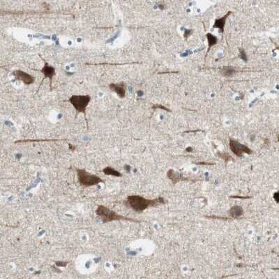 Immunohistochemistry-Paraffin: PSD-95 Antibody [NBP1-80875]