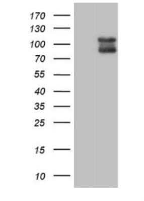 Western Blot: PSD-95 Antibody (OTI12A5)Azide and BSA Free [NBP2-73679]