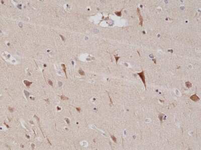 Immunohistochemistry-Paraffin: PSD-95 Antibody (RM288) [NBP2-61581]