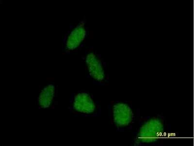 Immunocytochemistry/ Immunofluorescence: PSD Antibody [H00005662-B01P]