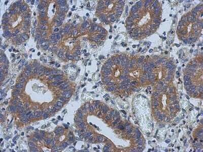 Immunohistochemistry-Paraffin: PSD Antibody [NBP2-15083]