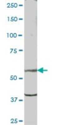 Western Blot: PSD Antibody [H00005662-B01P]