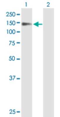 Western Blot: PSD Antibody [H00005662-B01P]