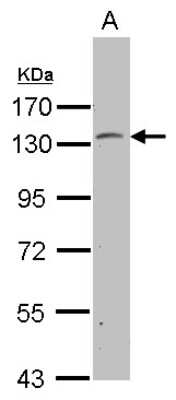 Western Blot: PSD Antibody [NBP2-15083]