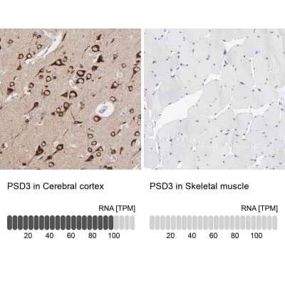 Immunohistochemistry-Paraffin: PSD3 Antibody [NBP2-55678]