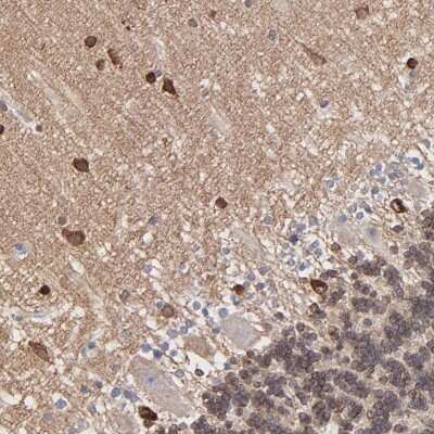 Immunohistochemistry-Paraffin: PSD3 Antibody [NBP2-55678]