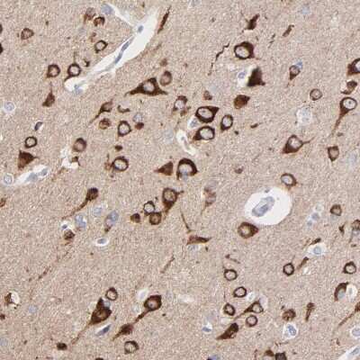 Immunohistochemistry-Paraffin: PSD3 Antibody [NBP2-55678]