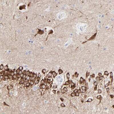 Immunohistochemistry-Paraffin: PSD3 Antibody [NBP2-55678]