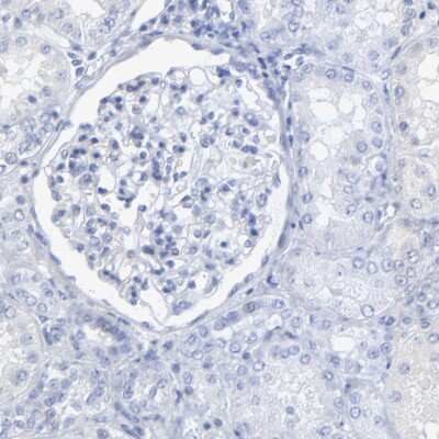 Immunohistochemistry-Paraffin: PSD3 Antibody [NBP2-55678]