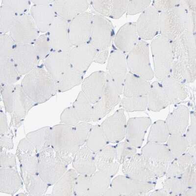 Immunohistochemistry-Paraffin: PSD3 Antibody [NBP2-55678]