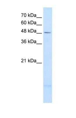 Western Blot: PSD3 Antibody [NBP1-55339]