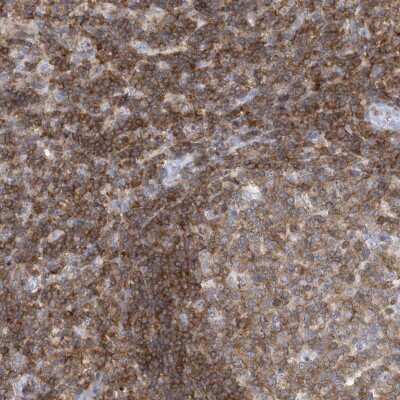 Immunohistochemistry-Paraffin: PSD4 Antibody [NBP1-84006]