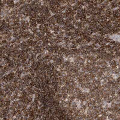 Immunohistochemistry-Paraffin: PSD4 Antibody [NBP2-38217]