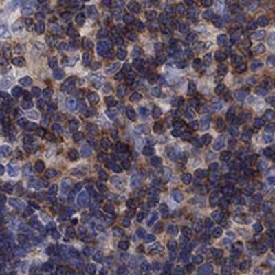 Immunohistochemistry-Paraffin: PSD4 Antibody [NBP3-17298]