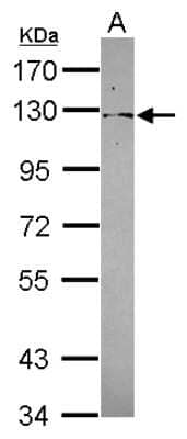 Western Blot: PSD4 Antibody [NBP2-19976]