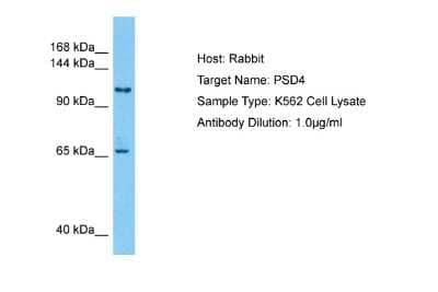 Western Blot: PSD4 Antibody [NBP2-88098]