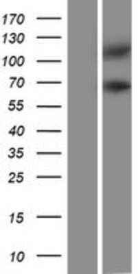 Western Blot: PSD4 Overexpression Lysate [NBP2-07441]