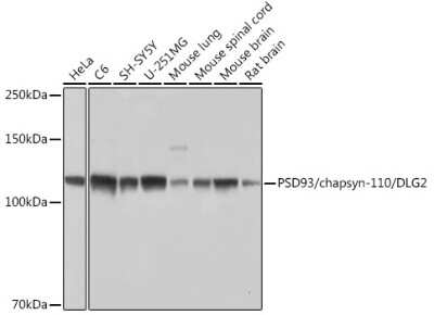 Western Blot: PSD93 Antibody (0G4O6) [NBP3-15849]