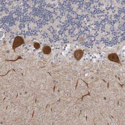Immunohistochemistry-Paraffin: PSD93 Antibody [NBP1-88088]