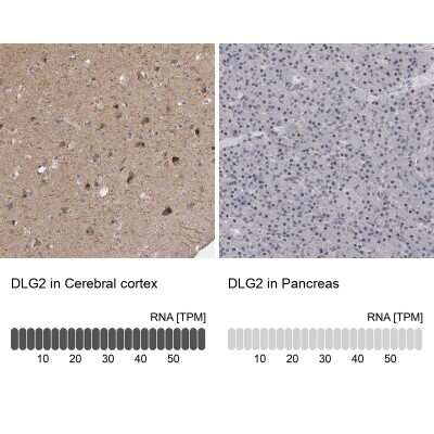 Immunohistochemistry-Paraffin: PSD93 Antibody [NBP1-88088]