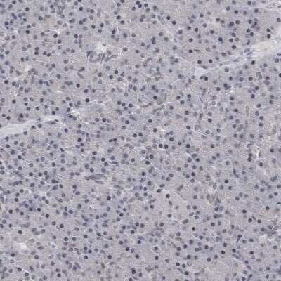 Immunohistochemistry-Paraffin: PSD93 Antibody [NBP1-88088]